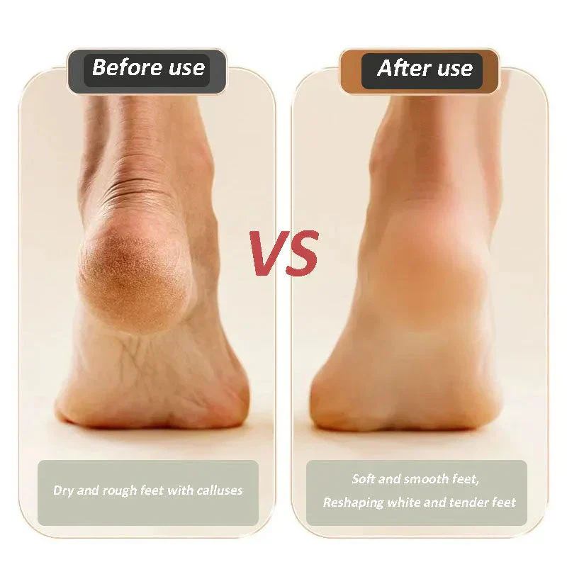 Nouveau Appareil de Réparation et de Ponçage des Pieds Rechargeable par USB - Image 9