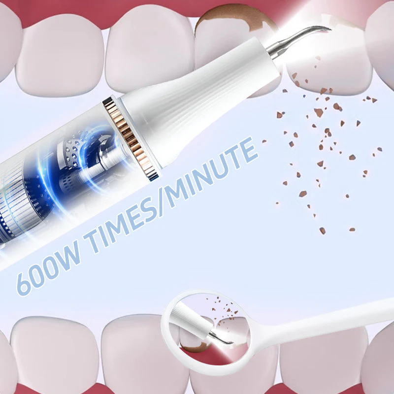 🔥50% de réduction🔥Un irrigateur à ultrasons destiné à blanchir les dents et à éliminer les tartres dentaires. - Image 4
