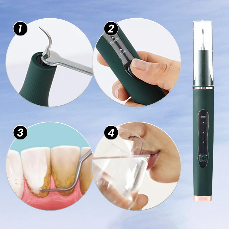 🔥50% de réduction🔥Un irrigateur à ultrasons destiné à blanchir les dents et à éliminer les tartres dentaires. - Image 7